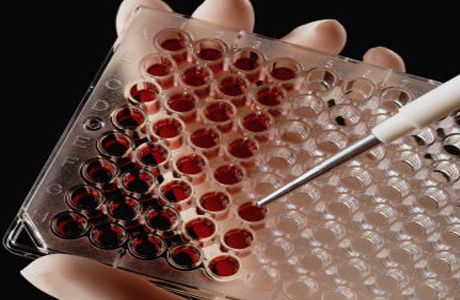 Lây truyền HIV qua đường tình dục khác giới: những khám phá mới