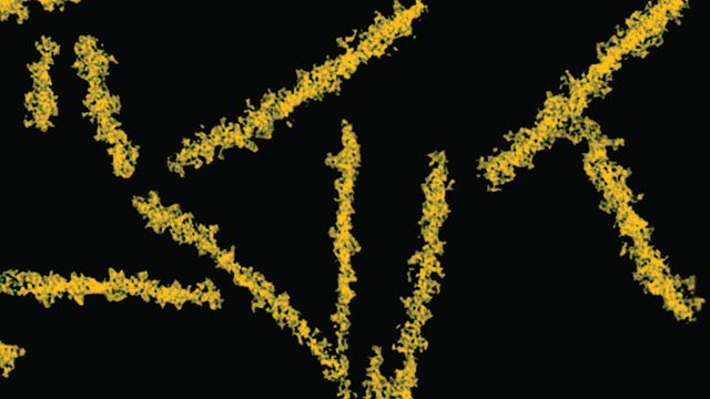 Prion - tác nhân gây bệnh prion